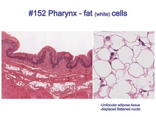 #152 Pharynx - fat (white) cells
-Unilocular adipose tissue
-displaced flattened nuclei
 