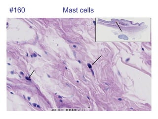 #160 Mast cells
 