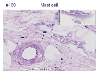 #160 Mast cell
 