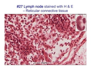 #27 Lymph node stained with H & E
– Reticular connective tissue
 