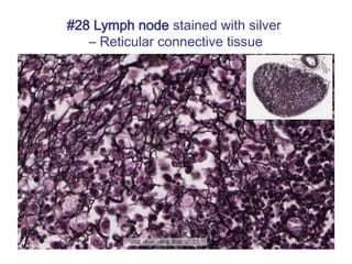 #28 Lymph node stained with silver
– Reticular connective tissue
 