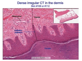 Dense irregular CT in the dermis
Skin #106 or #112
Dermis
Dermis
 