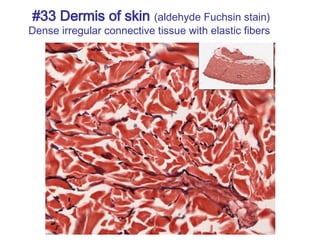 #33 Dermis of skin (aldehyde Fuchsin stain)
Dense irregular connective tissue with elastic fibers
 