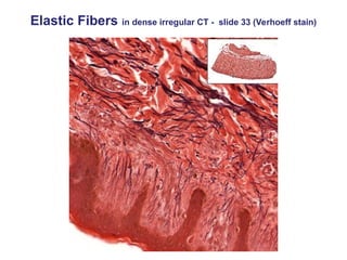 Elastic Fibers in dense irregular CT - slide 33 (Verhoeff stain)
 