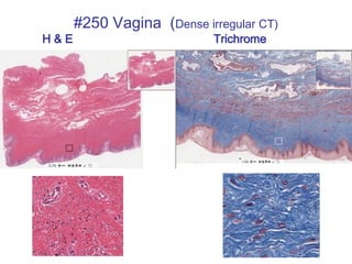 #250 Vagina (Dense irregular CT)
H & E Trichrome
 