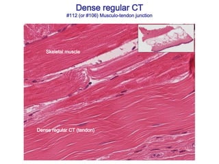 Skeletal muscle
Dense regular CT (tendon)
Dense regular CT
#112 (or #106) Musculo-tendon junction
 