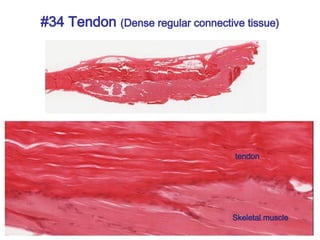 #34 Tendon (Dense regular connective tissue)
tendon
Skeletal muscle
 