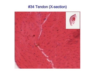 #34 Tendon (X-section)
 