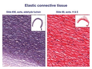 Slide #36, aorta, aldehyde fuchsin Slide 88, aorta. H & E
Elastic connective tissue
 