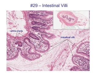 #29 – Intestinal Villi
Lamina propria
 