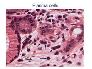 Plasma cells
 