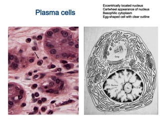 Plasma cells
Eccentrically located nucleus
Cartwheel appearance of nucleus
Basophilic cytoplasm
Egg-shaped cell with clear outline
 