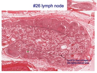 #26 lymph node
Look for macrophages in
this lightly stained area
 