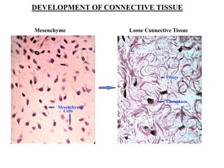DEVELOPMENT OF CONNECTIVE TISSUE
Mesenchyme Loose Connective Tissue
Mesenchymal
Cells
Fibroblasts
Fibers
 