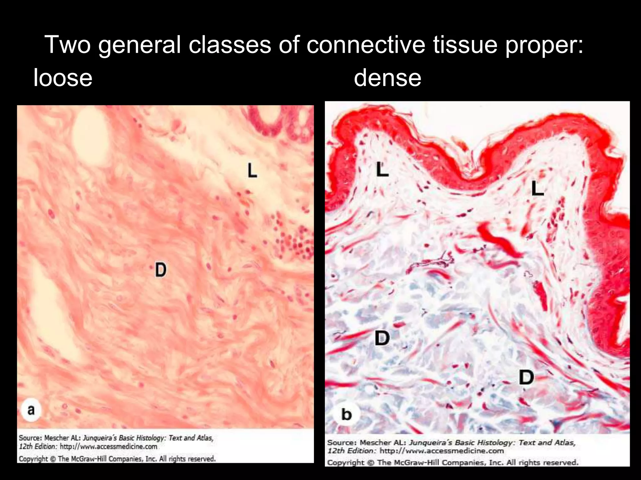 Two general classes of connective tissue proper:
loose dense
 