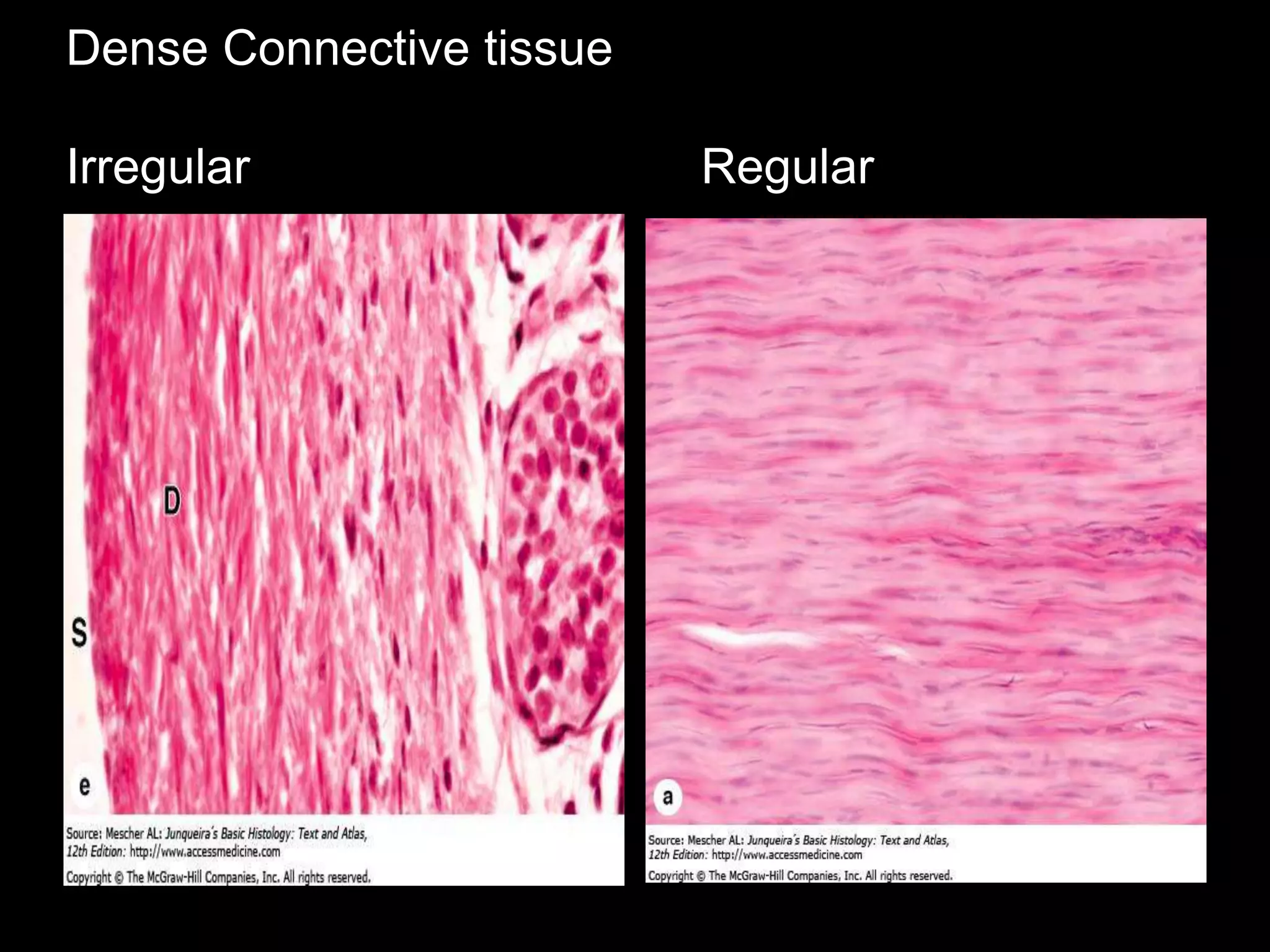 Dense Connective tissue
Irregular Regular
 