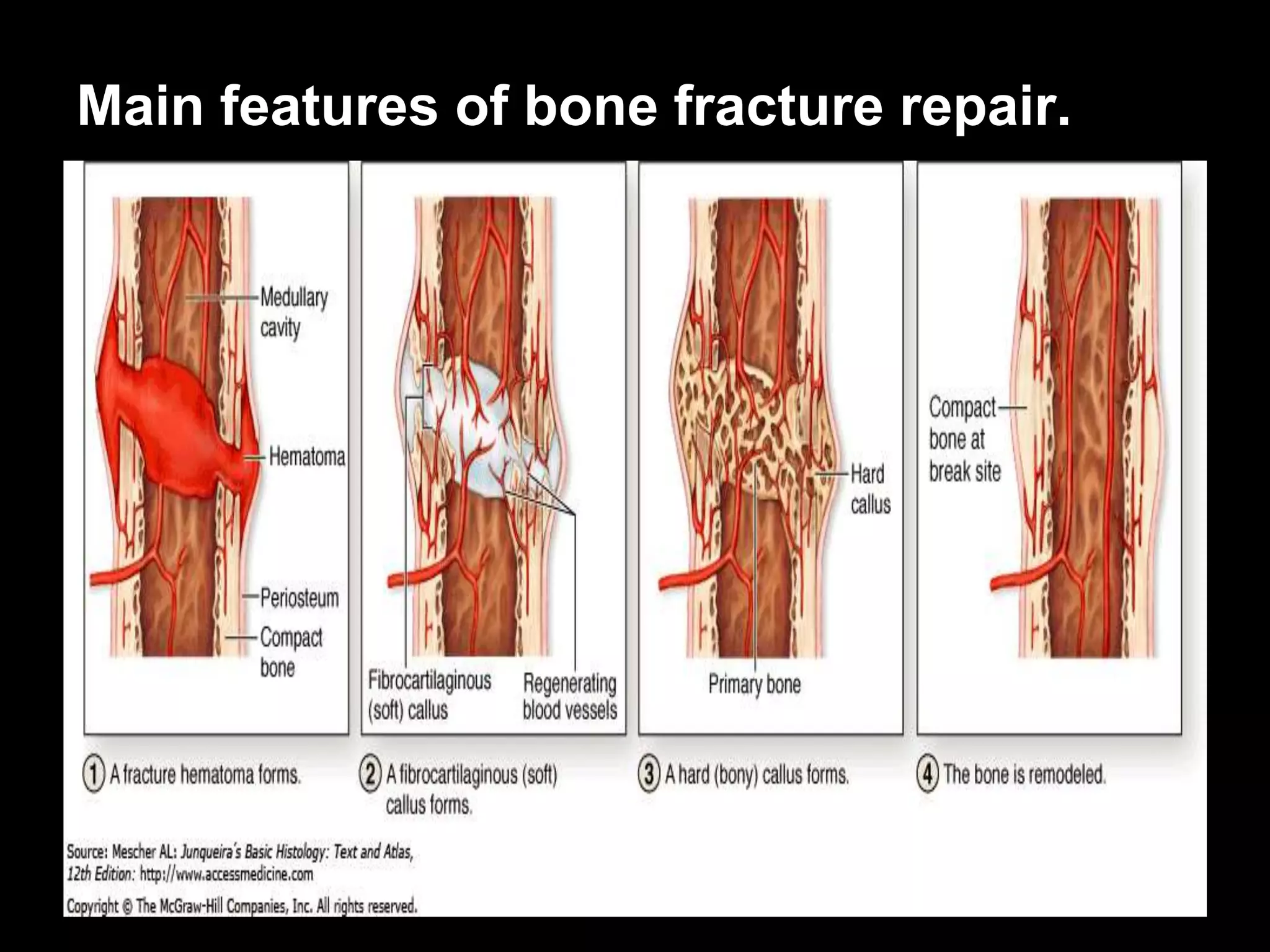 Main features of bone fracture repair.
 