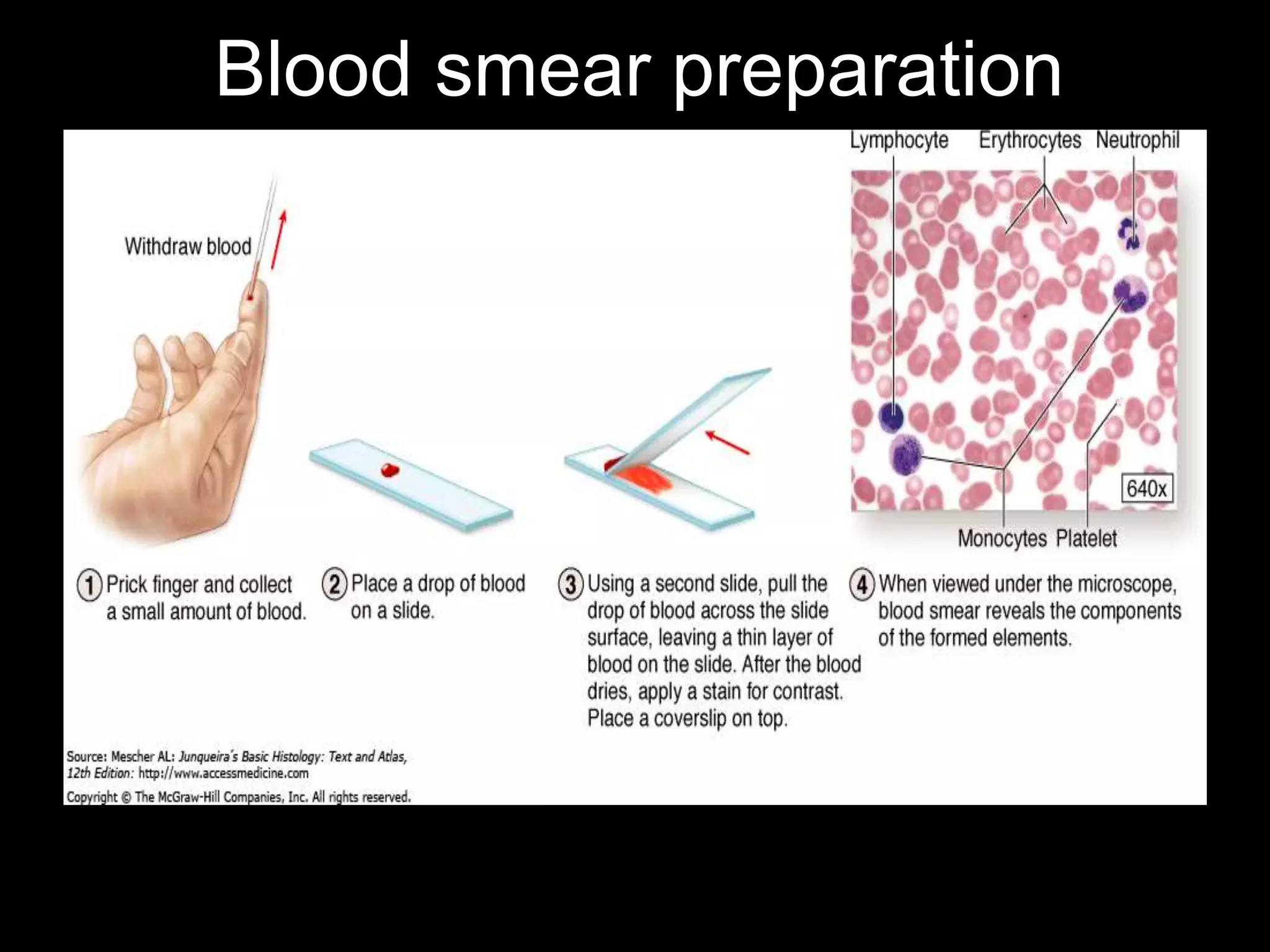 Blood smear preparation
 