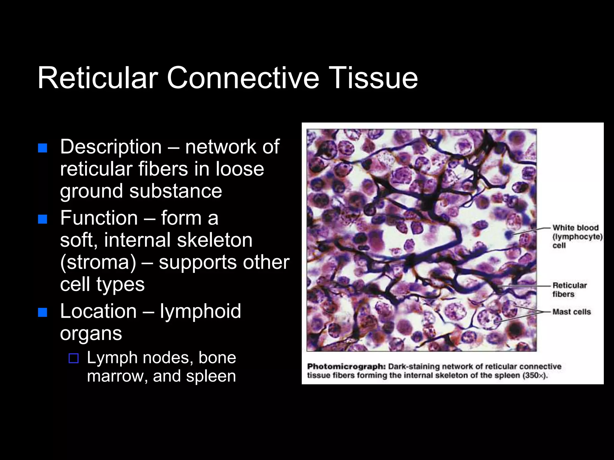 Reticular Connective Tissue
 Description – network of
reticular fibers in loose
ground substance
 Function – form a
soft, internal skeleton
(stroma) – supports other
cell types
 Location – lymphoid
organs
 Lymph nodes, bone
marrow, and spleen
 