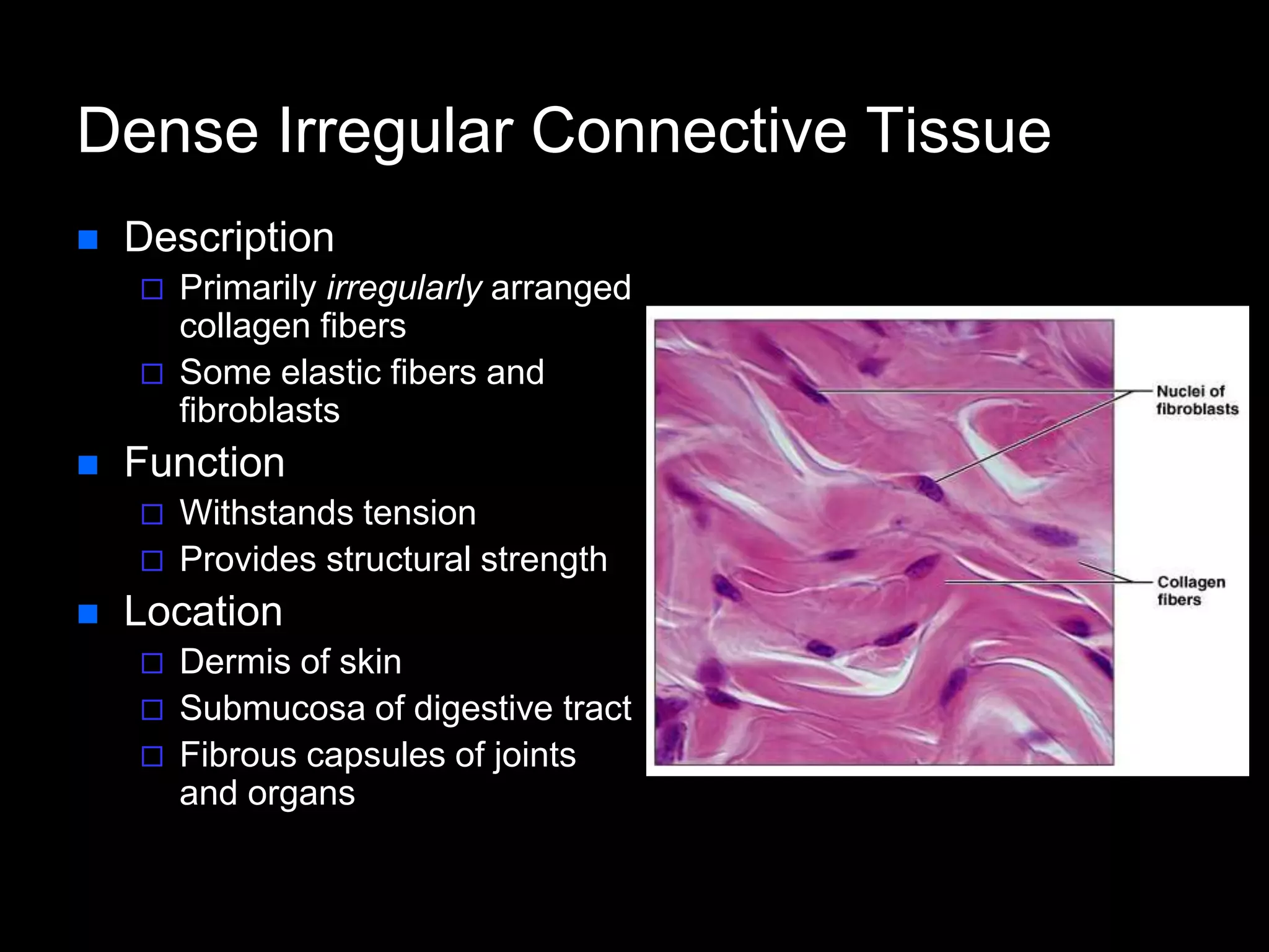 Dense Irregular Connective Tissue
 Description
 Primarily irregularly arranged
collagen fibers
 Some elastic fibers and
fibroblasts
 Function
 Withstands tension
 Provides structural strength
 Location
 Dermis of skin
 Submucosa of digestive tract
 Fibrous capsules of joints
and organs
 