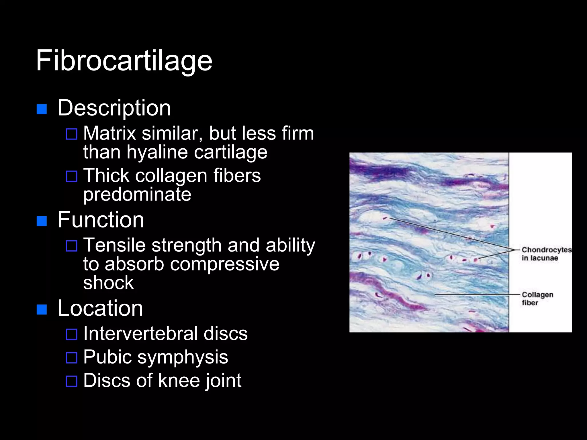 Fibrocartilage
 Description
 Matrix similar, but less firm
than hyaline cartilage
 Thick collagen fibers
predominate
 Function
 Tensile strength and ability
to absorb compressive
shock
 Location
 Intervertebral discs
 Pubic symphysis
 Discs of knee joint
 
