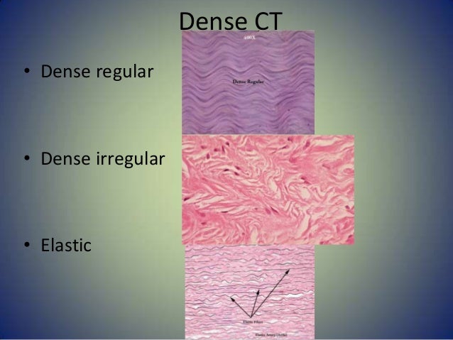 connective irregular areolar reticular cartilage adipose hyaline