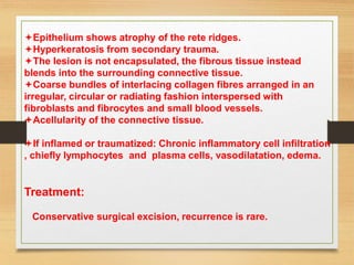Epithelium shows atrophy of the rete ridges.
Hyperkeratosis from secondary trauma.
The lesion is not encapsulated, the fibrous tissue instead
blends into the surrounding connective tissue.
Coarse bundles of interlacing collagen fibres arranged in an
irregular, circular or radiating fashion interspersed with
fibroblasts and fibrocytes and small blood vessels.
Acellularity of the connective tissue.
If inflamed or traumatized: Chronic inflammatory cell infiltration
, chiefly lymphocytes and plasma cells, vasodilatation, edema.
Treatment:
Conservative surgical excision, recurrence is rare.
 