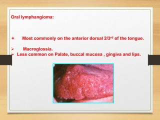 Oral lymphangioma:
 Most commonly on the anterior dorsal 2/3rd of the tongue.
 Macroglossia.
 Less common on Palate, buccal mucosa , gingiva and lips.
 