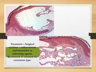 Treatment – Surgical
excision – radioresistant
and insensitive to
sclerosing agents.
Recurrence is common for
cavernous type.
 