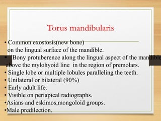 Torus mandibularis
• Common exostosis(new bone)
on the lingual surface of the mandible.
 Bony protuberence along the lingual aspect of the mandible
above the mylohyoid line in the region of premolars.
• Single lobe or multiple lobules paralleling the teeth.
• Unilateral or bilateral (90%)
• Early adult life.
• Visible on periapical radiographs.
•Asians and eskimos,mongoloid groups.
•Male predilection.
 