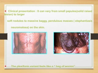  Clinical presentation : It can vary from small papules(solid raised
lesion) to larger
soft nodules to massive baggy, pendulous masses ( elephantiasis
neuromatosa) on the skin.
 The plexiform variant feels like a “ bag of worms”.
 