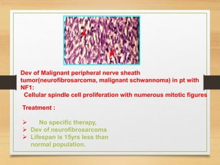 Treatment :
 No specific therapy,
 Dev of neurofibrosarcoma
 Lifespan is 15yrs less than
normal population.
Dev of Malignant peripheral nerve sheath
tumor(neurofibrosarcoma, malignant schwannoma) in pt with
NF1:
Cellular spindle cell proliferation with numerous mitotic figures
 