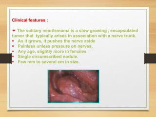 Clinical features :
 The solitary neurilemoma is a slow growing , encapsulated
tumor that typically arises in association with a nerve trunk.
 As it grows, it pushes the nerve aside
 Painless unless pressure on nerves.
 Any age, slightly more in females
 Single circumscribed nodule.
 Few mm to several cm in size.
 