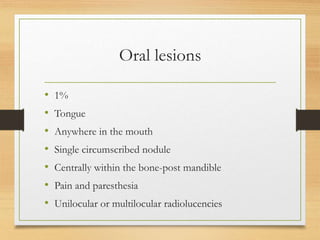 Oral lesions
• 1%
• Tongue
• Anywhere in the mouth
• Single circumscribed nodule
• Centrally within the bone-post mandible
• Pain and paresthesia
• Unilocular or multilocular radiolucencies
 