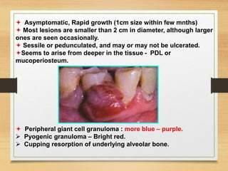  Asymptomatic, Rapid growth (1cm size within few mnths)
 Most lesions are smaller than 2 cm in diameter, although larger
ones are seen occasionally.
 Sessile or pedunculated, and may or may not be ulcerated.
Seems to arise from deeper in the tissue - PDL or
mucoperiosteum.
 Peripheral giant cell granuloma : more blue – purple.
 Pyogenic granuloma – Bright red.
 Cupping resorption of underlying alveolar bone.
 