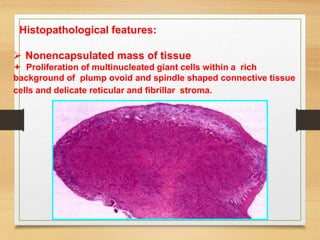 Histopathological features:
 Nonencapsulated mass of tissue
 Proliferation of multinucleated giant cells within a rich
background of plump ovoid and spindle shaped connective tissue
cells and delicate reticular and fibrillar stroma.
 