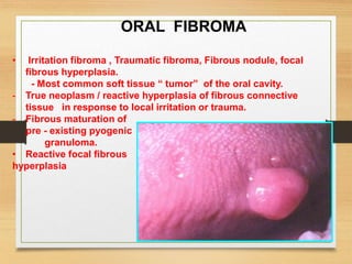 ORAL FIBROMA
• Irritation fibroma , Traumatic fibroma, Fibrous nodule, focal
fibrous hyperplasia.
- Most common soft tissue “ tumor” of the oral cavity.
- True neoplasm / reactive hyperplasia of fibrous connective
tissue in response to local irritation or trauma.
- Fibrous maturation of
pre - existing pyogenic
granuloma.
• Reactive focal fibrous
hyperplasia
 