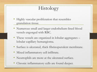 Histology
• Highly vascular proliferation that resembles
granulation tissue.
• Numerous small and larger endothelium-lined blood
vessels engorged with RBC.
• These vessels are organized in lobular aggregates –
lobular capillary hemangioma.
• Surface is ulcerated, thick fibrinopurulent membrane.
• Mixed inflammatory cell infiltrate.
• Neutrophils are more at the ulcerated surface.
• Chronic inflammatory cells are found deeper.
 