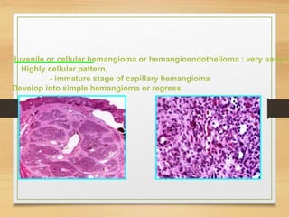 Juvenile or cellular hemangioma or hemangioendothelioma : very early in
Highly cellular pattern,
- immature stage of capillary hemangioma
Develop into simple hemangioma or regress.
 