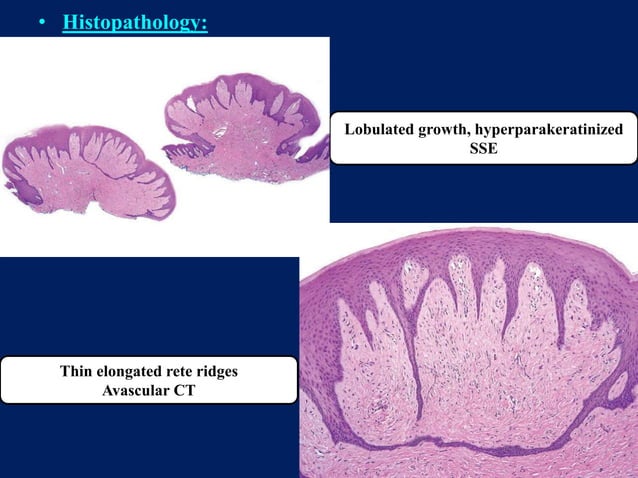 benign and malignant tumors of connective tissue origin | PPTX | Dental ...