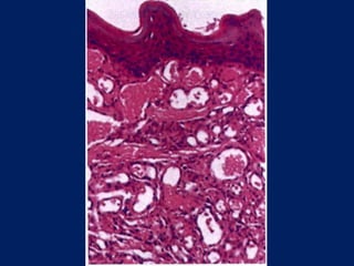 benign and malignant tumors of connective tissue origin | PPTX