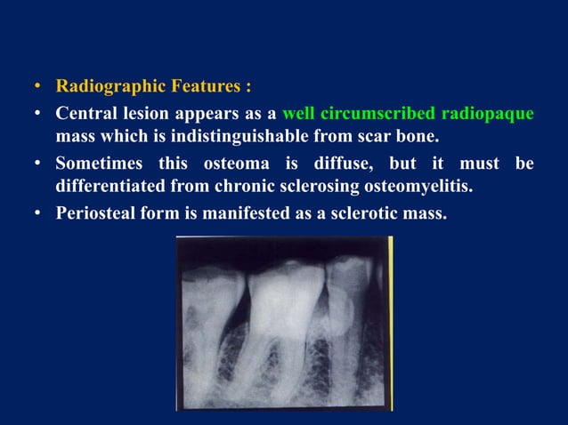 benign and malignant tumors of connective tissue origin | PPTX | Dental ...