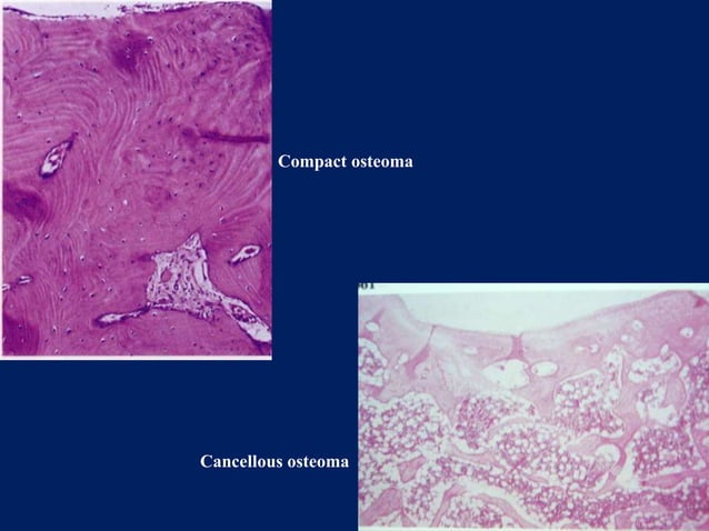 benign and malignant tumors of connective tissue origin | PPTX | Dental ...