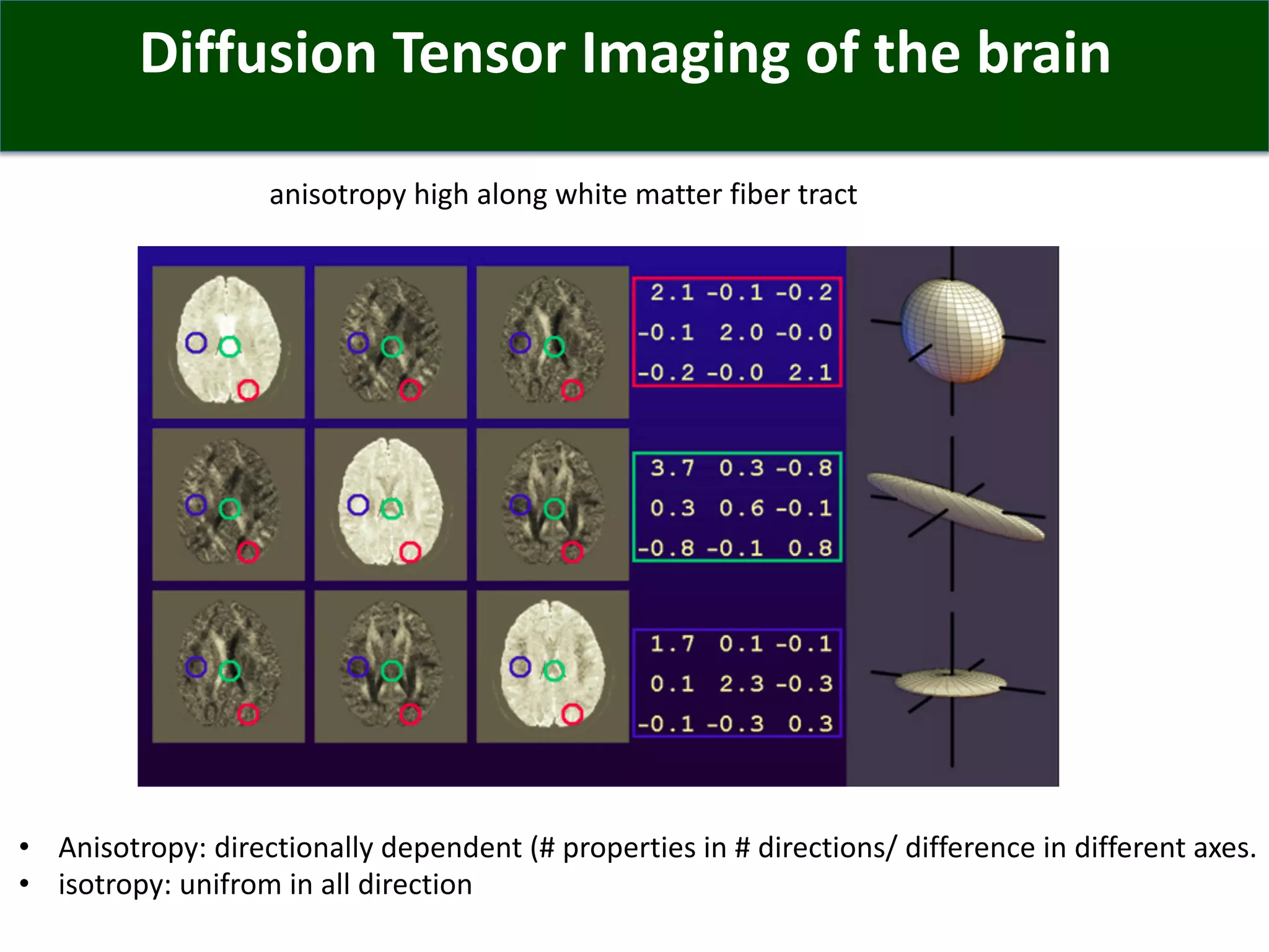 Diffusion Tensor Imaging of the brain
anisotropy high along white matter fiber tract
• Anisotropy: directionally dependent (# properties in # directions/ difference in different axes.
• isotropy: unifrom in all direction
 