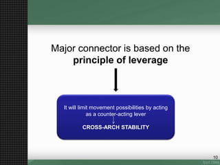 Major connector is based on the
principle of leverage
10
It will limit movement possibilities by acting
as a counter-acting lever
CROSS-ARCH STABILITY
 