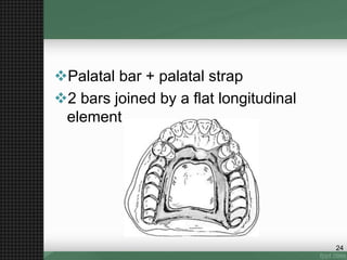 Palatal bar + palatal strap
2 bars joined by a flat longitudinal
element
24
 