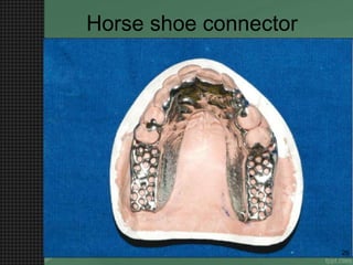 Horse shoe connector
26
 