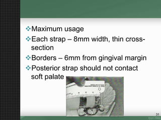 Maximum usage
Each strap – 8mm width, thin cross-
section
Borders – 6mm from gingival margin
Posterior strap should not contact
soft palate
31
 