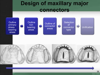 Design of maxillary major
connectors
:
Outline
primary
stress
bearing
areas
Outline
non
bearing
areas
Outline of
connector
areas
Selection
of
connector
type
Unification
38
 