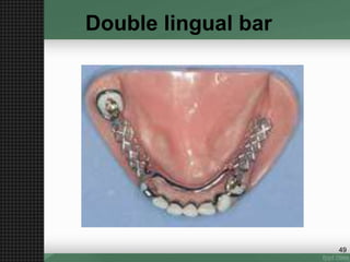 Double lingual bar
49
 